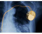 醫療植入有機硅材料